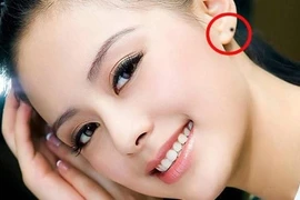 Phụ nữ sở hữu nốt ruồi này, coi chừng... giàu mất gỡ