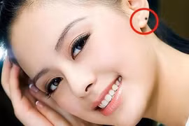 Phụ nữ sở hữu nốt ruồi này, coi chừng... giàu mất gỡ