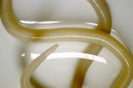 Sởn gai ốc với thế giới kỳ dị của các loài giun tròn 