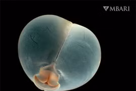 Khoa học bối rối về loài giun lạ có hình dạng giống mông lợn