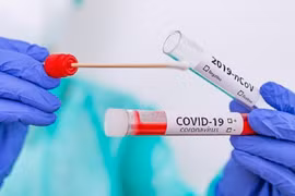 Ngày 25/8 Việt Nam ghi nhận 3.342 ca COVID-19, thêm 2 bệnh nhân tử vong 