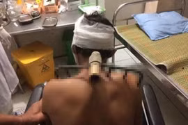 Vì sao con trai bổ bồ cào vào vai bố trong bữa cơm?