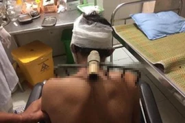 Vì sao con trai bổ bồ cào vào vai bố trong bữa cơm?