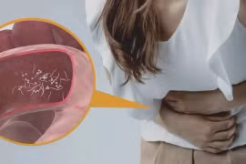 Những dấu hiệu cảnh báo đến lúc bạn cần sổ giun