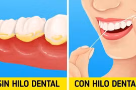 Giảm ngay mùi hôi miệng nhanh chóng với những cách đơn giản này 