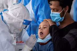 Các yếu tố nguy cơ gây nên bệnh COVID-19 nghiêm trọng ở trẻ em