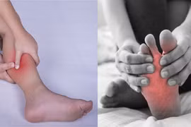 Bị chuột rút liên tục khi ngủ, dấu hiệu cơ thể 'cầu cứu'?