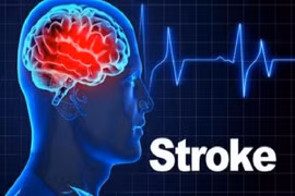 Dấu hiệu cảnh báo sớm cơn đột quỵ nhiều người bỏ qua