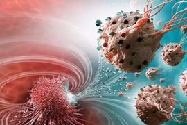 Giật mình thực phẩm gây ung thư phổ biến, tránh càng xa càng tốt