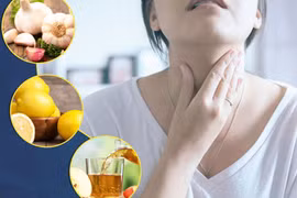 Thực phẩm tốt cho người bị bướu cổ