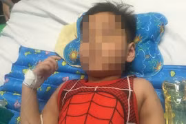 Cứu thành công chân trái bé trai bị ô tô cán dập nát đùi