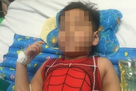 Cứu thành công chân trái bé trai bị ô tô cán dập nát đùi