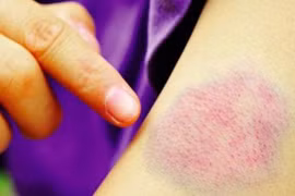  Thấy da thế này đi khám ngay kẻo tới lúc bán nhà cũng chẳng cứu được