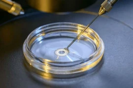 Phương pháp 'phẫu thuật' ADN để chữa tan máu bẩm sinh