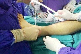 Lần đầu tiên nội soi khớp cổ chân bệnh lý hiếm gặp