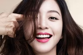 8 điểm cần lưu ý trước khi làm trắng răng 