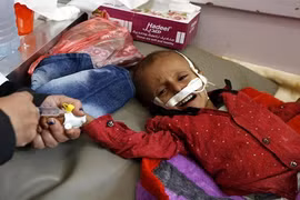 Chiến tranh liên miên, hàng triệu trẻ Yemen bị suy dinh dưỡng