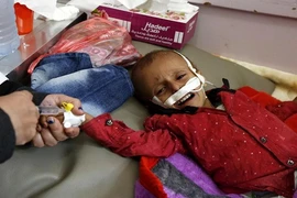 Chiến tranh liên miên, hàng triệu trẻ Yemen bị suy dinh dưỡng
