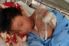 Cha tạt nước sôi khiến con trai bị bỏng nặng: CA Thanh Hoá vào cuộc