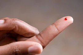 Cắt đôi que thử HIV ở Xanh Pôn: Lây truyền "căn bệnh thế kỷ" kiểu mới