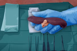 Rợn người cảnh bán thận ở chợ đen