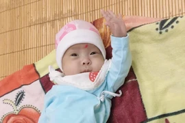 Hành trình sống sót kỳ diệu của bé sơ sinh nhẹ cân nhất Việt Nam