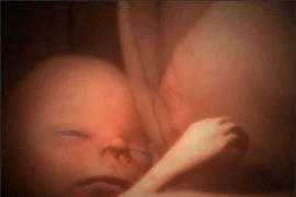 Tan chảy với hình ảnh đáng yêu của các bé song thai, đa thai trong bụng mẹ