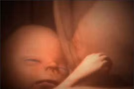 Tan chảy với hình ảnh đáng yêu của các bé song thai, đa thai trong bụng mẹ