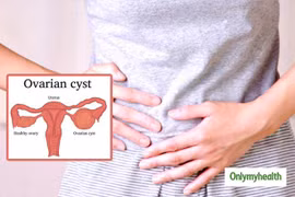 Các dấu hiệu cảnh báo nguy cơ u nang buồng trứng chị em không thể bỏ qua