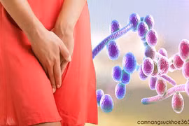 Chị em phụ nữ bàng hoàng khi đi bơi dính ngay bệnh vùng kín