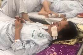 Vi khuẩn 'ăn mũi người' đang hoành hành và những sự thật kinh hoàng