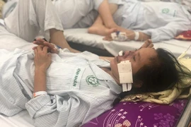 Vi khuẩn 'ăn mũi người' đang hoành hành và những sự thật kinh hoàng