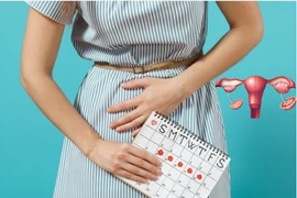 6 dấu hiệu u nang buồng trứng thường gặp