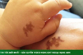 Cay đắng phát hiện con gái bạn thân có vết bớt giống chồng mình