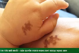 Cay đắng phát hiện con gái bạn thân có vết bớt giống chồng mình