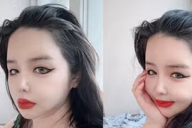 Park Bom hỏng nhan sắc vì nghiện phẫu thuật thẩm mỹ