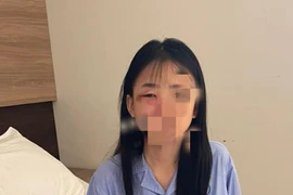 Nữ sinh lớp 8 ở Hà Nội nghi bị đánh hội đồng đến nhập viện 
