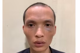 Hà Nội: Đã bắt được kẻ dùng kim tiêm đe dọa cướp điện thoại 