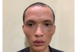 Hà Nội: Đã bắt được kẻ dùng kim tiêm đe dọa cướp điện thoại 