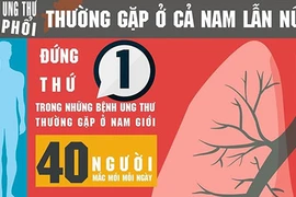 Bệnh Minh Thuận mắc khiến 17.000 người Việt chết mỗi năm