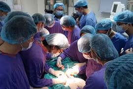 Tái tạo lại mặt cho nữ bệnh nhân bị bệnh ung thư ăn mòn