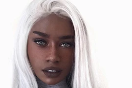 Nữ người mẫu gây tranh cãi với màu tóc và da đối lập