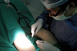 Rụng rời chứng kiến những ca phẫu thuật thẩm mỹ gọt chân