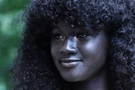 Hành trình của cô gái đen nhẻm trở thành người mẫu nổi tiếng