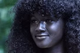 Hành trình của cô gái đen nhẻm trở thành người mẫu nổi tiếng