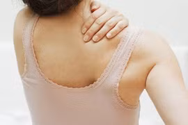 Vì sao bệnh loãng xương lại giết chết nhiều phụ nữ đến thế?