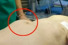 Những dấu hiệu cho thấy sức khỏe bạn đang nguy kịch