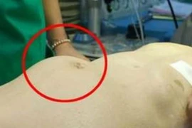 Những dấu hiệu cho thấy sức khỏe bạn đang nguy kịch