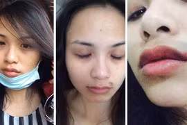 Bi hài chuyện sao Việt, quản lý bị đánh bầm dập 