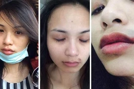 Bi hài chuyện sao Việt, quản lý bị đánh bầm dập 